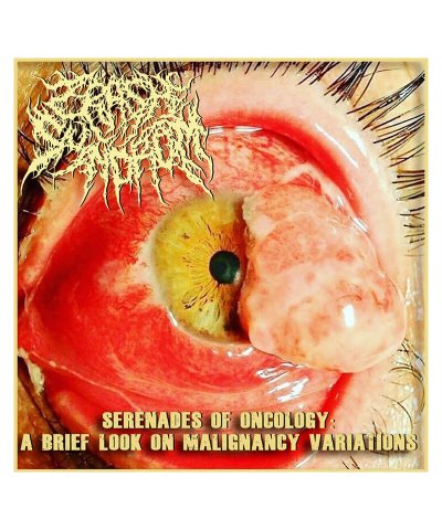 CD / DVD / CRASH SYNDROM / CANNIBE：SERENADES OF ONCOLOGY / A BRIEF LOOK ON MALIGNANCY VARIATIONS (輸入盤CD) 