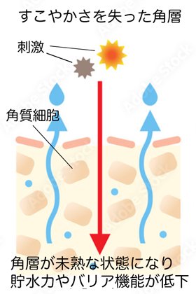 化粧水 必要 安い 不必要